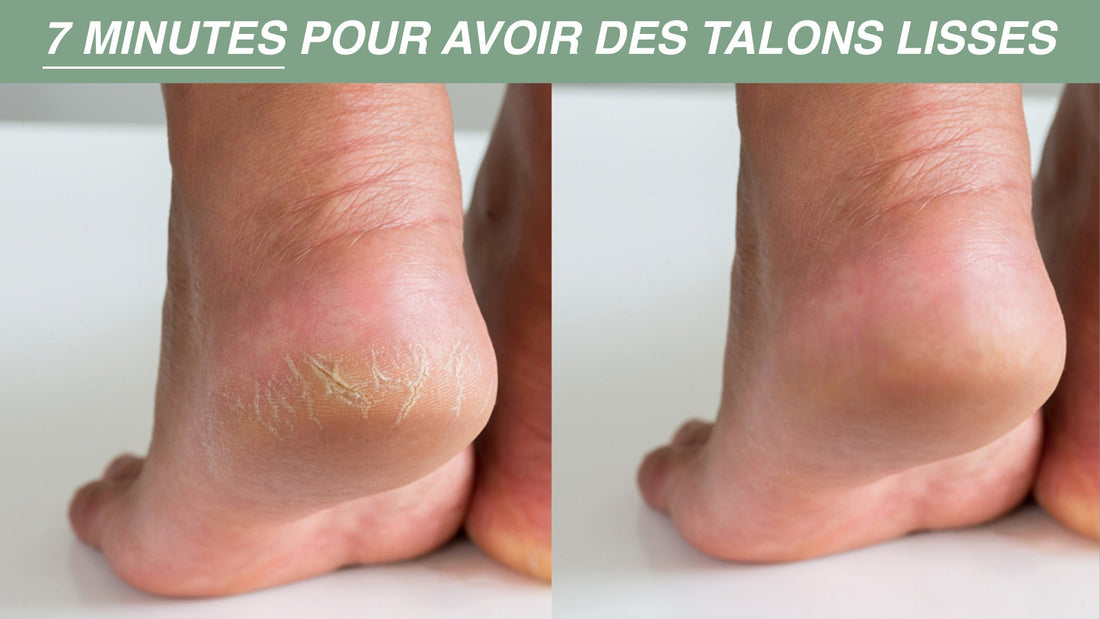 Talons lisses à la maison : le rituel 7 minutes (sans rendez-vous)